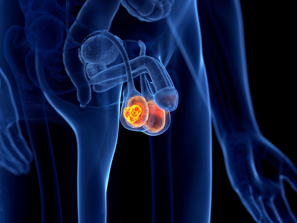 Variasi Anatomi Normal yang Menyebabkan Testis Terlihat Turun Sebelah